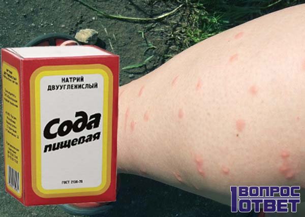 Избавиться от раздражения на коже от укуса комара с помощью соды